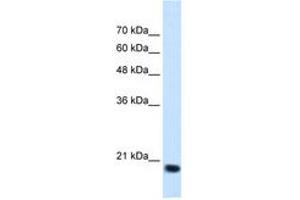 Image no. 2 for anti-Signal Sequence Receptor, beta (Translocon-Associated Protein Beta) (SSR2) (N-Term) antibody (ABIN205080)