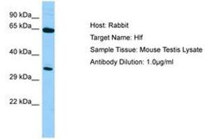 Image no. 1 for anti-Hepatic Leukemia Factor (HLF) (N-Term) antibody (ABIN6749814)
