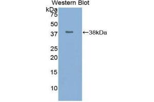 Image no. 1 for anti-Ubiquitin Carboxyl-terminal Hydrolase L5 (UCHL5) (AA 2-316) antibody (ABIN1860898)