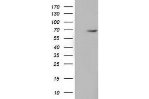 Image no. 2 for anti-EPM2A (Laforin) Interacting Protein 1 (EPM2AIP1) antibody (ABIN2720298)