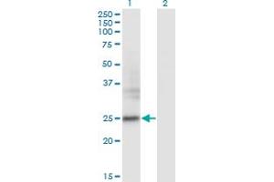 Image no. 2 for anti-Fibronectin Type III Domain Containing 4 (FNDC4) (AA 45-154) antibody (ABIN566281)