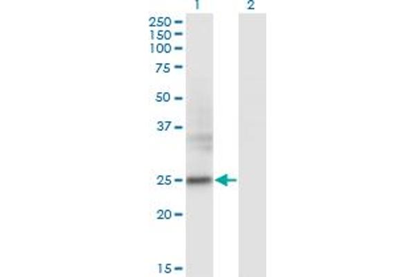 FNDC4 anticorps  (AA 45-154)