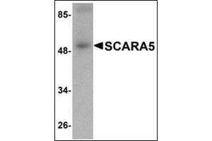Image no. 2 for anti-Scavenger Receptor Class A, Member 5 (SCARA5) (C-Term) antibody (ABIN500680)