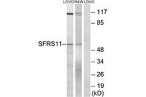 Image no. 1 for anti-serine/arginine-Rich Splicing Factor 11 (SRSF11) (AA 211-260) antibody (ABIN1535394)