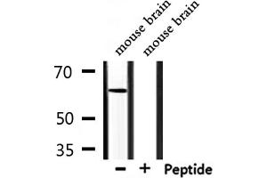 Image no. 4 for anti-Ceramide Kinase-Like (CERKL) (Internal Region) antibody (ABIN6260772)