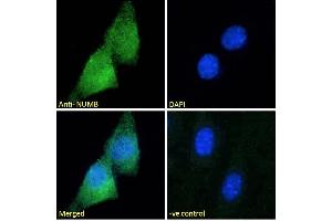 Image no. 3 for anti-Numb Homolog (NUMB) (C-Term) antibody (ABIN184679)
