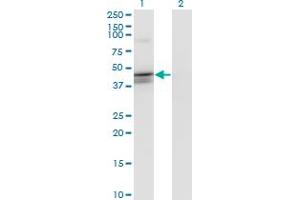 Western Blot analysis of CANT1 expression in transfected 293T cell line by CANT1 monoclonal antibody (M02), clone 1A1.