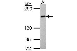 Image no. 2 for anti-UDP-Glucose Glycoprotein Glucosyltransferase 2 (UGT2) (Internal Region) antibody (ABIN2855712)