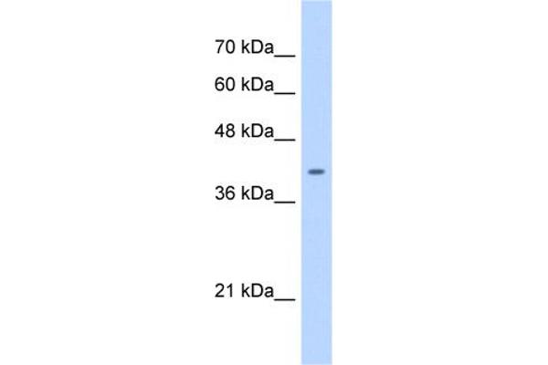 anti-ST6 (Alpha-N-Acetyl-Neuraminyl-2,3-beta-Galactosyl-1,3)-N-Acetylgalactosaminide alpha-2,6-Sialyltransferase 6 (ST6GALNAC6) (C-Term) antibody