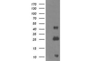 Image no. 5 for anti-Aldehyde Dehydrogenase 1 Family, Member A3 (ALDH1A3) (AA 1-100), (AA 413-512) antibody (ABIN1490536)