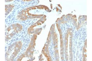 Image no. 3 for anti-Keratin 19 (KRT19) antibody (ABIN6939940)