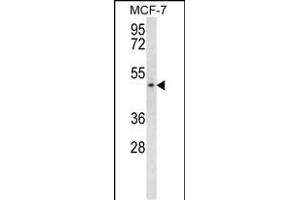 SCD5 抗体  (AA 147-175)