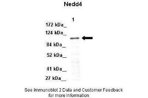 Image no. 2 for anti-Neural Precursor Cell Expressed, Developmentally Down-Regulated 4, E3 Ubiquitin Protein Ligase (NEDD4) (Middle Region) antibody (ABIN2774920)