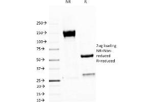 Image no. 1 for anti-Mucin 1 (MUC1) antibody (ABIN6940099)
