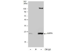 Image no. 2 for anti-Glutathione S-Transferase theta 1 (GSTT1) (full length) antibody (ABIN2856663)