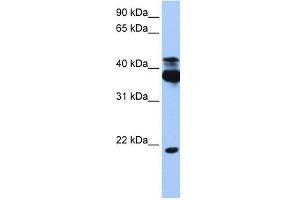 Image no. 1 for anti-serine/threonine Kinase 38 (STK38) (C-Term) antibody (ABIN634342)