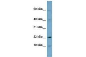 Image no. 1 for anti-Developmental Pluripotency Associated 5 (DPPA5) (N-Term) antibody (ABIN6741859)