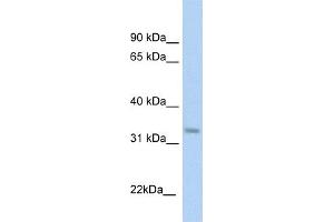 Image no. 2 for anti-Ketohexokinase (KHK) (C-Term) antibody (ABIN2776775)