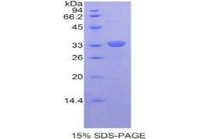 Image no. 1 for V-Rel Reticuloendotheliosis Viral Oncogene Homolog B (RELB) protein (ABIN3012213)