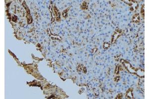 ABIN6272849 at 1/100 staining Mouse kidney tissue by IHC-P.