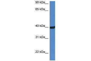 Image no. 1 for anti-Ornithine Carbamoyltransferase (OTC) (C-Term) antibody (ABIN2776983)