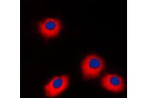 Image no. 2 for anti-ES cell expressed Ras (ERAS) (C-Term) antibody (ABIN2704771)
