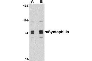 Image no. 2 for anti-Syntaphilin (SNPH) (Middle Region) antibody (ABIN1031114)