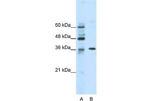 Image no. 1 for anti-Zinc Finger Protein 124 (ZNF124) (N-Term) antibody (ABIN2780515)
