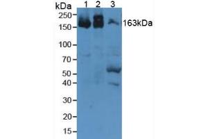 Image no. 2 for anti-alpha-2-Macroglobulin (A2M) (AA 1053-1214) antibody (ABIN1857846)