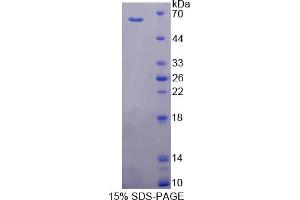 Image no. 1 for Cytochrome P450, Family 11, Subfamily B, Polypeptide 1 (CYP11B1) (AA 1-498) protein (T7 tag,His tag) (ABIN6236997)