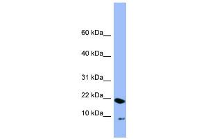Image no. 1 for anti-Peptidyl Prolyl Cis/Trans Isomerase NIMA Interacting 4 Protein (PIN4) (N-Term) antibody (ABIN2786841)