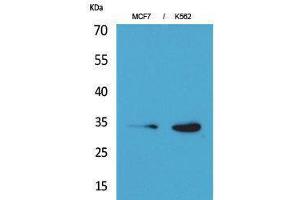 anti-Cyclin-Dependent Kinase 4 (CDK4) (N-Term) antibody