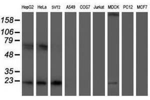Image no. 8 for anti-Ubiquitin-Conjugating Enzyme E2E 3 (UBE2E3) antibody (ABIN1501618)