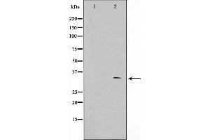 Image no. 1 for anti-Adenomatous Polyposis Coli (APC) (pSer2054) antibody (ABIN6255083)