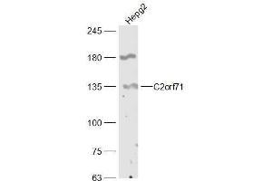 anti-Chromosome 2 Open Reading Frame 71 (C2orf71) (AA 701-800) antibody