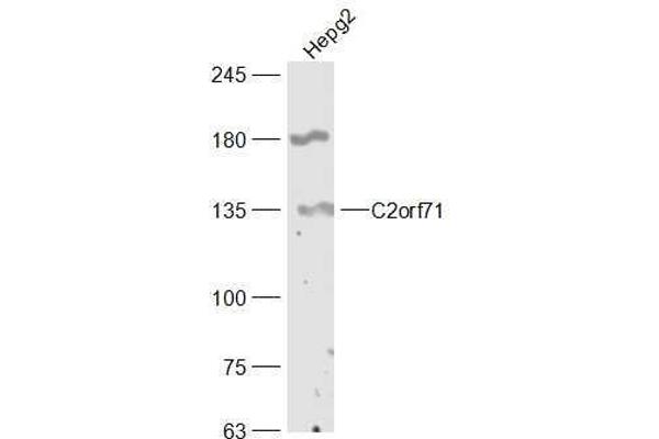 anti-Chromosome 2 Open Reading Frame 71 (C2orf71) (AA 701-800) antibody