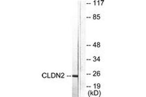 Image no. 1 for anti-Claudin 2 (CLDN2) (AA 181-230) antibody (ABIN1533225)