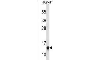 RPS23 Antibody (N-term) (ABIN1538877 and ABIN2850072) western blot analysis in Jurkat cell line lysates (35 μg/lane).