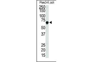 Image no. 2 for anti-Protein Inhibitor of Activated STAT, 3 (PIAS3) (AA 588-619) antibody (ABIN1882115)