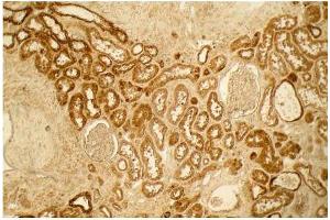 Image no. 18 for anti-Collagen, Type I (COL1) antibody (ABIN5596819)