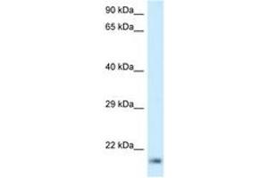 Image no. 1 for anti-Ribosomal Protein L23A (RPL23A) (C-Term) antibody (ABIN6747503)