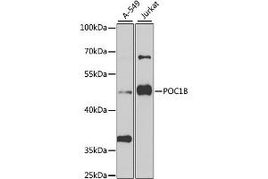 Image no. 2 for anti-POC1 Centriolar Protein Homolog B (POC1B) antibody (ABIN2560765)