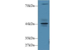 Image no. 1 for anti-Fibrosin (FBS) (AA 1-250) antibody (ABIN5013556)