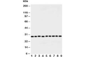 Western blot testing of Peroxiredoxin 3 antibody and rat samples: 1.