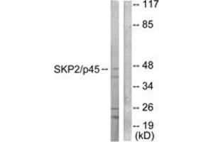 Image no. 1 for anti-S-Phase Kinase-Associated Protein 2 (SKP2) (AA 366-415) antibody (ABIN1533399)