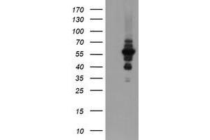 Image no. 2 for anti-Diphthamide Biosynthesis Protein 2 (DPH2) antibody (ABIN2719694)