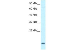 Image no. 1 for anti-Ubiquitin-Conjugating Enzyme E2N (UBE2N) (Middle Region) antibody (ABIN2778258)