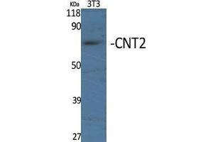 Image no. 1 for anti-Solute Carrier Family 28 (Sodium-Coupled Nucleoside Transporter), Member 2 (SLC28A2) (Internal Region) antibody (ABIN3183992)