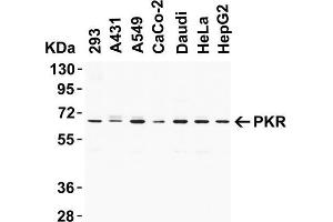 Image no. 1 for anti-Eukaryotic Translation Initiation Factor 2-alpha Kinase 2 (EIF2AK2) (C-Term) antibody (ABIN6656999)