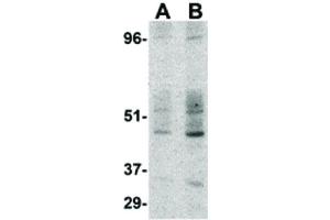 Image no. 1 for anti-CD209 (CD209) (Internal Region) antibody (ABIN6655339)